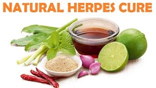 Herpes Cure  Natural Home Remedies For Herpes [upl. by Duleba]