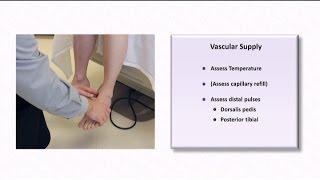 The Diabetic Foot Exam [upl. by Akemak]